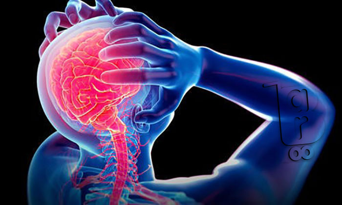 علائم میگرن چشمی،میگرن عصبی چه علائمی دارد،علائم میگرن مزمن،علائم میگرن معده،علائم میگرن قاعدگی،تشخیص میگرن،خطرات میگرن،قرص میگرن عصبی