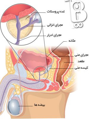 پروستات احتمال مرگ در سرطان پروستات، تشخیص سرطان پروستات، درمان گیاهی سرطان پروستات، سرطان پروستات بدخیم، سرطان پروستات گرید ۴، سرطان پروستات و کمردرد، علائم عود سرطان پروستات، متاستاز سرطان پروستات